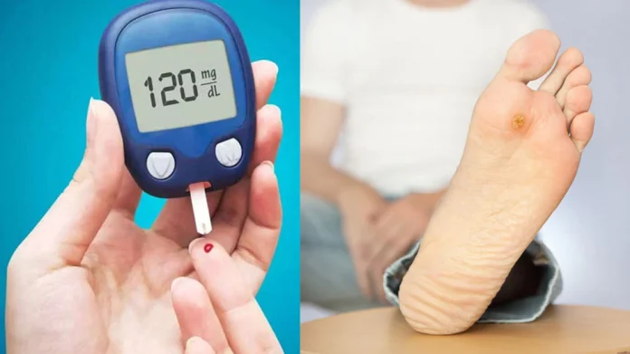 Diabetes Warning Signs and Symptoms of Diabetes, Blood Sugar Test Diabetes होतो तेव्हा आपल्याला पाय देतात हे धोकादायक संकेत, तात्काळ करा Blood Sugar Test