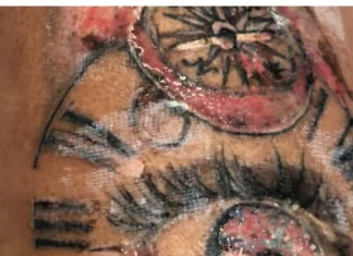 Elder, woman reached hospital after getting foot tattoo done; Now the trouble is happening in the phase Elder, woman reached hospital after getting foot tattoo done; Now the trouble is happening in the phase