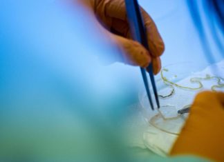 “Fatty liver disease”: Inventiva signs a major agreement with the Chinese Sino Biopharm Le traitement de la maladie est en cours d'évaluation dans une étude clinique de Phase III, la dernière.