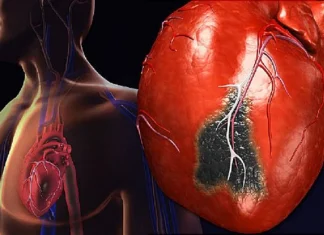 Heart Attack: Beware…! Heart attack in ‘this’ age group; read big reason Heart attack : सावधान…! 'या' वयोगटातील तरुणांना हृदयविकाराचा झटका; वाचा मोठे कारण