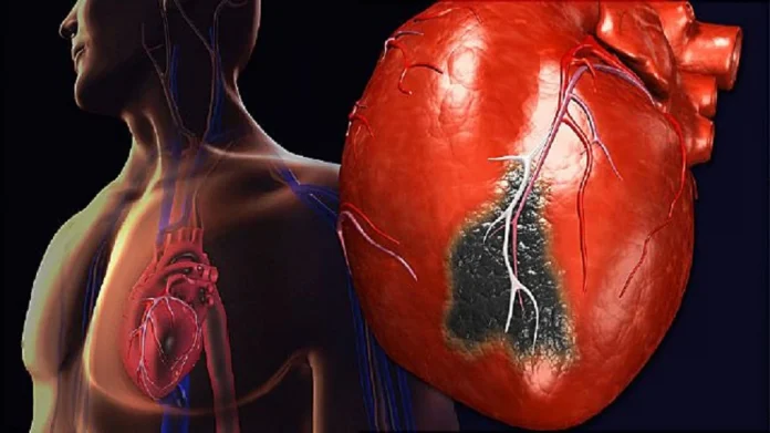 Heart attack : सावधान…! &#039;या&#039; वयोगटातील तरुणांना हृदयविकाराचा झटका; वाचा मोठे कारण