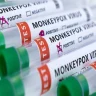 Monkeypox virus: First death due to monkeypox in America, 15 deaths worldwide