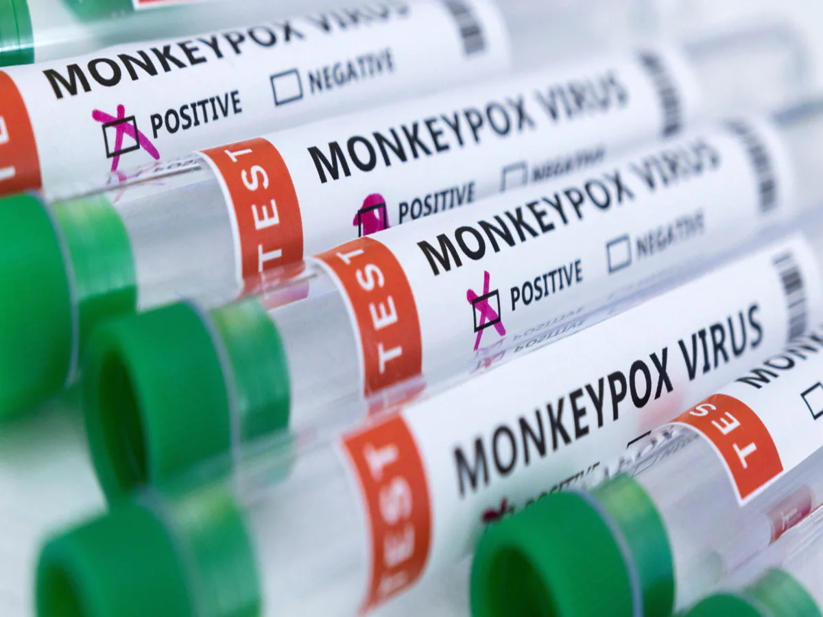 Monkeypox virus: First death due to monkeypox in America, 15 deaths worldwide

