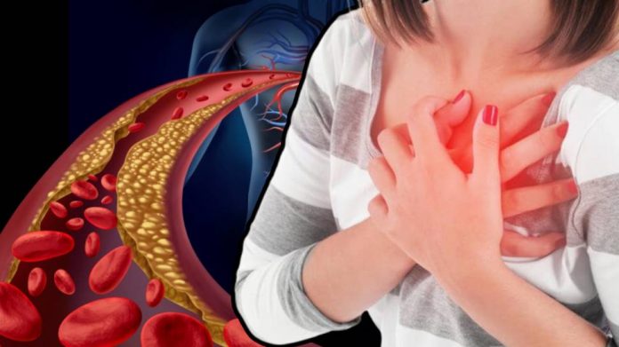 Palm and your feet alerts you about increased cholesterol in Cholesterol Check: तळ हात आणि पाय देतात शरीरातील वाढत्या कोलेस्ट्रॉलबाबत अलर्ट, कसा जाणून घ्या