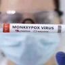 Panic spreading due to monkeypox in Brazil, poison in more than 10 ports, WHO angry
