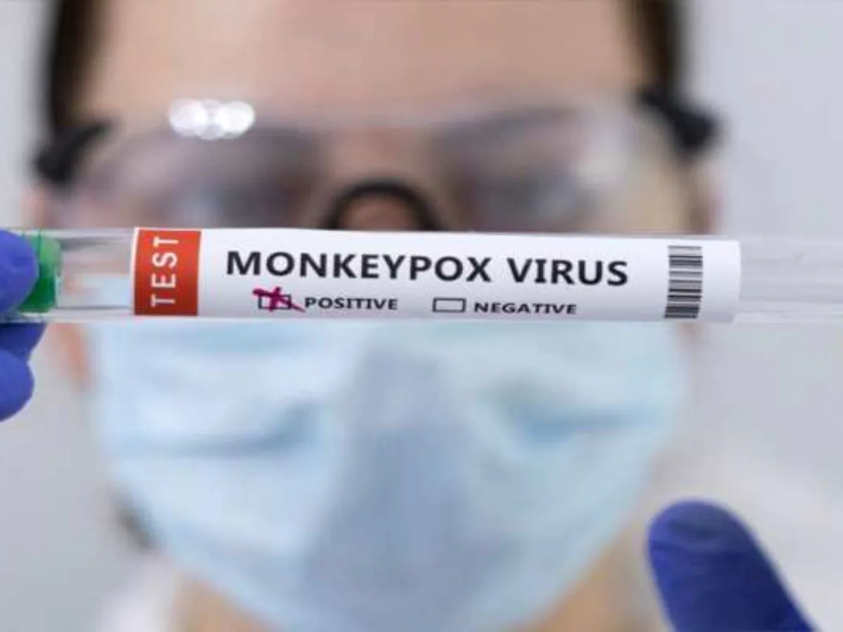 Panic spreading due to monkeypox in Brazil, poison in more than 10 ports, WHO angry
