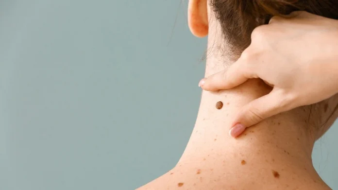 Samudrik Shastra means having moles on different parts of the Samudrik Shastra: शरीराच्या या भागावरील तीळ ठरतो शुभ, लक्ष्मी आणि कुबेराची असते कृपा