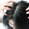 Hair Care Tips: डोक्याला खाज सुटल्याने त्रास होतो? हे करा घरगुती उपाय