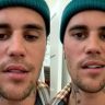 VIDEO: Justin Bieber got this dangerous disease, Paralysis happened on Singer's face, he himself expressed pain