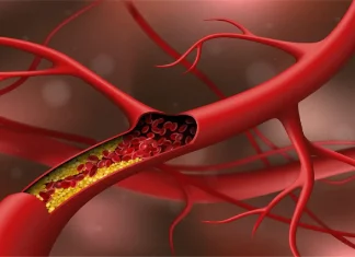 Cholesterol level things can increase cholesterol in the body, get rid of it today Cholesterol ची पातळी अचानक वाढवू शकतात 'या' गोष्टी!