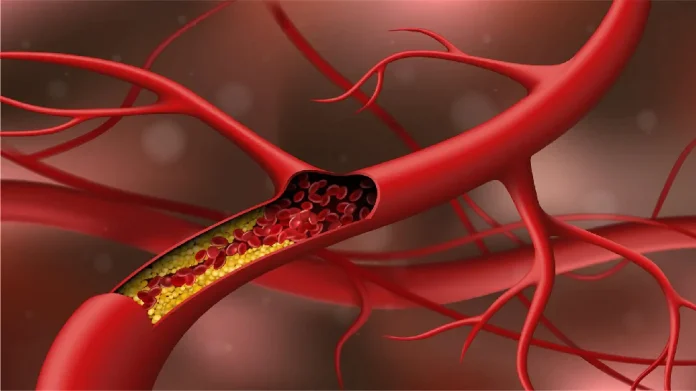 Cholesterol ची पातळी अचानक वाढवू शकतात &#039;या&#039; गोष्टी!