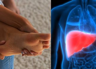 Itching in the palms and soles is a symptom of a bad liver, consult a doctor before it is too late Liver Damage: तळहात आणि पायांना येतेय खाज, पैसे येणार नाहीत, लिव्हर आहे डॅमेज, डॉक्टरांना गाठा नाहीतर...