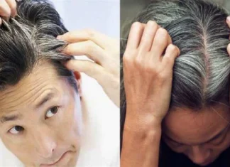 White hair when you are young, why does your hair turn white, then do these remedies White Hair: Why Your Hair Turns White When You Are Young... So Do These Remedies